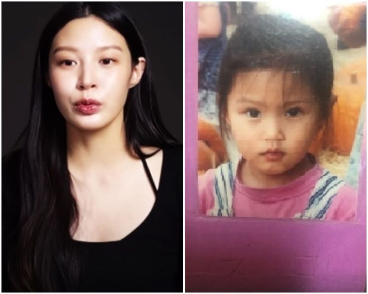 "머리부터 발끝까지 다 뜯어고쳤다" 성형 의혹에 조민, 사진 공개