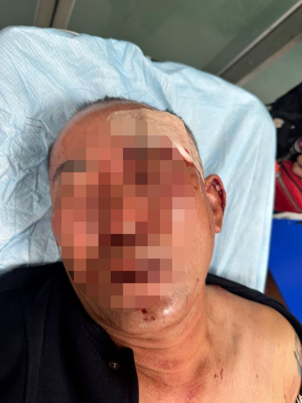 폭행을 말리는 과정에서 중상을 입은 50대 남성 C씨. [이미지출처=연합뉴스]