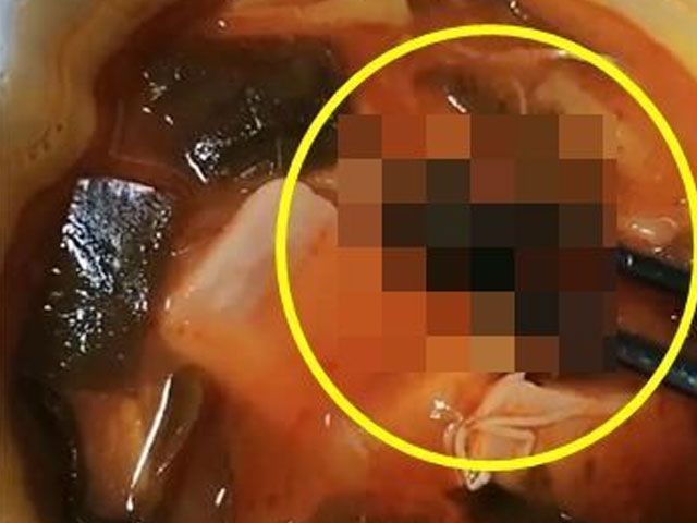 "하다하다 이젠 마라탕에서 박쥐까지 나왔다"…中식품위생 또 논란