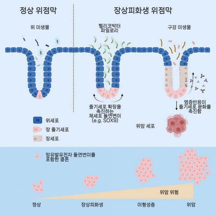 장상피화생 위점막. [이미지제공=서울대병원]