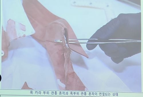 흉기로 관통된 이재명 대표 와이셔츠 옷깃[이미지출처=부산경찰청 제공, 연합뉴스]