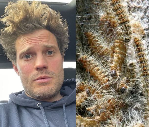 도넌은 포르투갈 여행 중 독성 애벌레와 접촉했다고 한다. [이미지출처=도넌 SNS, 비즈니스 인사이더]