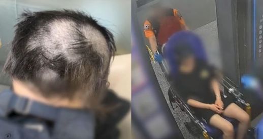전 남자친구에 의해 오피스텔에 갇혀 강간을 당하고 머리를 밀리는 등, 고문 수준의 가혹 행위를 당한 A씨의 모습. [사진=MBC '실화탐사대' 보도화면 갈무리]