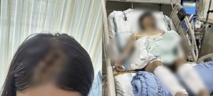 전 여자친구를 스토킹하다 신고당하자 흉기를 들고 직장에 찾아가 찌른 남성이 15년형을 선고받은 가운데 피해자의 가족은 출소 후 보복 범죄에 대한 우려와 공포를 드러냈다. 3일 한 온라인 커뮤니티에는 피해 여성의 언니인 A씨가 '＜부산 멍키스패너＞사건 1년 전 오늘이네요'란 제목의 글을 게시했다. [사진출처=온라인 커뮤니티]