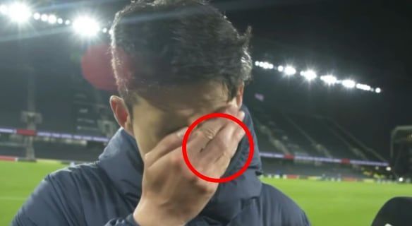 손흥민, 참패에 고개숙였는데…퉁퉁 부은 손가락 본 한국팬들 "안쓰럽다"