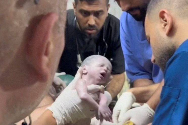 21일(현지시간) 의료진이 이스라엘의 공격으로 사망한 임신부의 몸에서 제왕절개 수술로 긴급하게 아기를 꺼내고 있다. [이미지출처=로이터연합뉴스]
