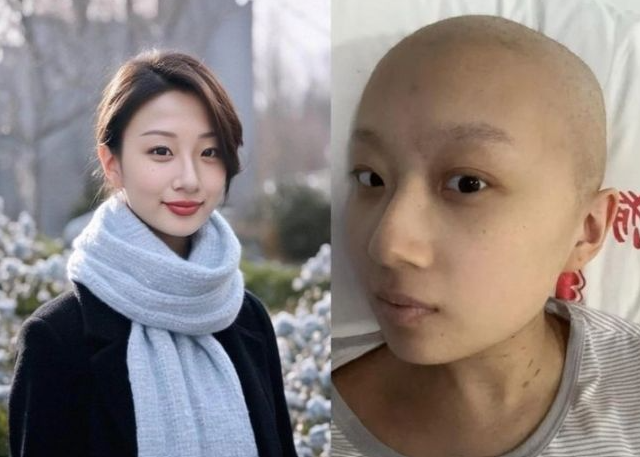 궈장이 AI로 모습을 바꾼 사진(왼쪽)과 암 투병 중인 현재 모습. [이미지출처=궈장 웨이보 캡처]