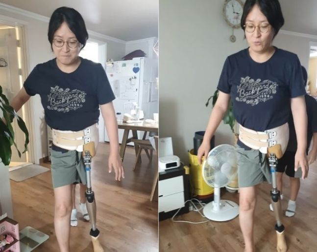 희귀암으로 왼쪽 골반 아래를 절단했던 전혜선씨가 처음으로 목발 없이 의족을 차고 걷는 모습을 공개했다. [이미지출처=유튜브 캡처]