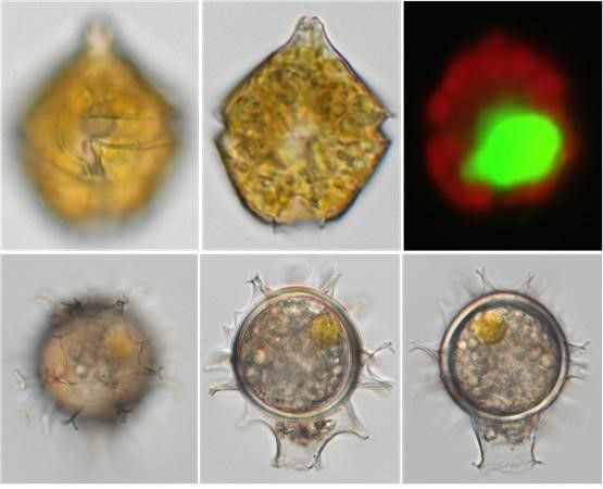 ‘곤얄록스 군산엔시스’의 유영세포와 휴면포자의 광학현미경 사진.