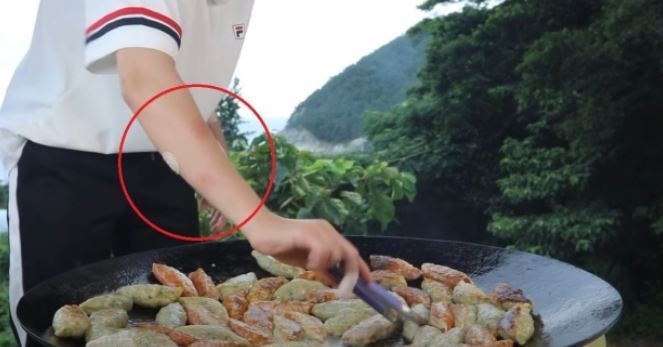 "Bruises and Bandage Wounds on Arm?"... Tzuyang's Past Broadcast Scene Revisited