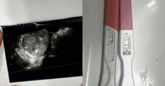 A씨가 온라인 폭로 글에 올렸던 사진 [이미지출처=온라인 커뮤니티 갈무리]