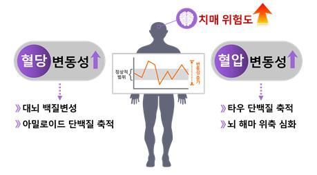 혈당·혈압 변화 클수록 '치매' 위험 높아진다