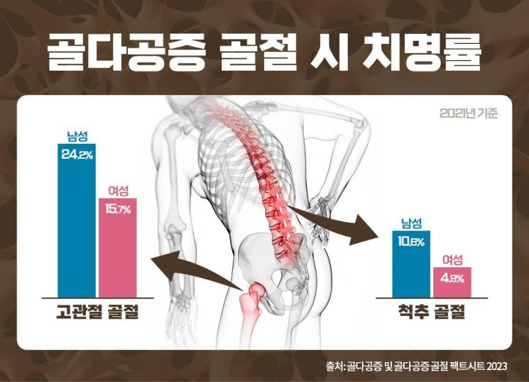 [콕!건강]오늘은 '골다공증의 날'…여성뿐만 아니라 남성도 주의해야