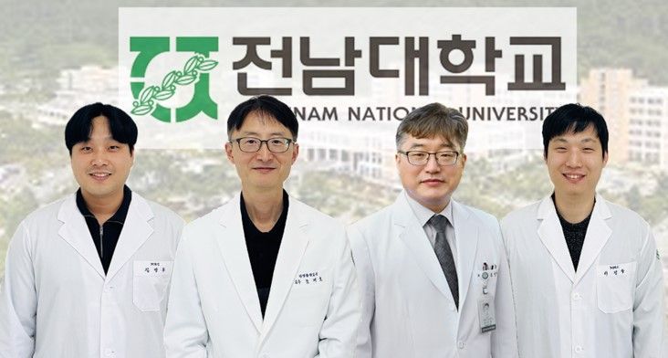 전남대 의대 공동연구팀, ‘폐암 조기진단’ 새 방법 개발