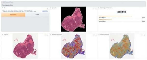 "1분 만에 암 잡아낸다"…LG AI연구원, AWS 활용 병리학 모델 개발