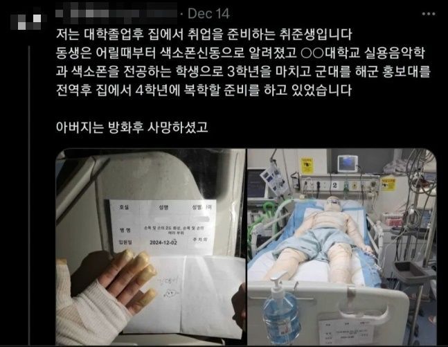 "수술비만 5억 들어요"…포항 아파트 방화 피해자 호소