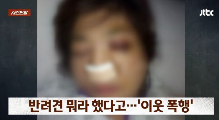 반려견 배변을 치우라고 지적했다가 개 주인에게 폭행당해 코뼈가 골절됐다는 사연이 전해졌다. JTBC '사건반장'