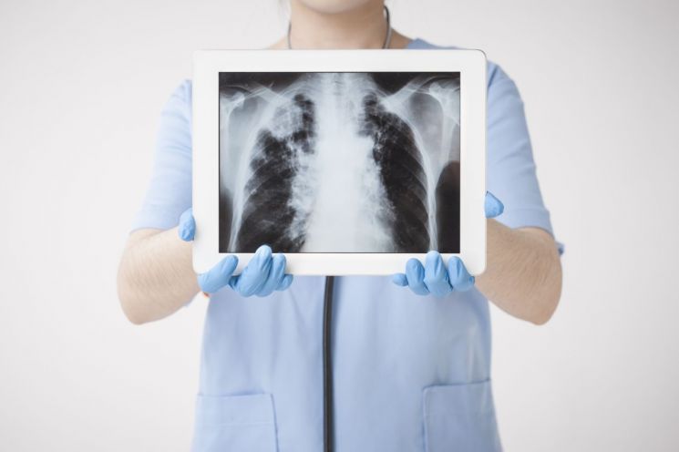 엑스레이. 클립아트코리아 제공