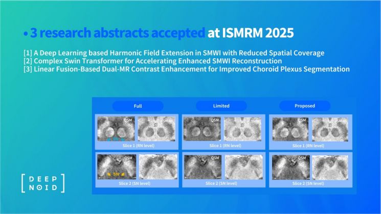 딥노이드, ISMRM 2025서 퇴행성 뇌질환 연구 발표