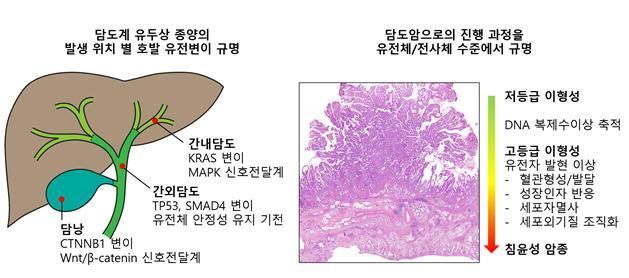 담도계 전암 병변으로부터 담도암이 발생하는 과정에서 나타나는 유전자 변이와 유전자 발현 이상 양상을 도식화 한 자료. 연세대 의과대학 박영년 교수 제공