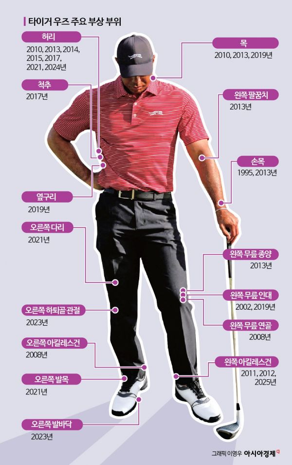 우즈가 부상을 당하지 않았다면