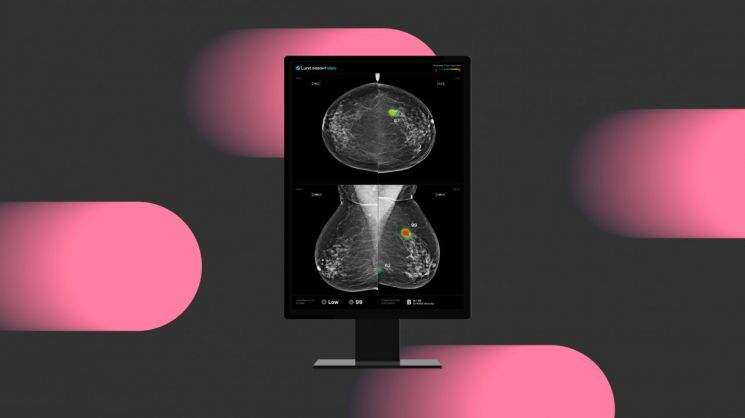 "의사-AI 협력 시 암 검진효율성 향상"…루닛, 글로벌 저널 게재