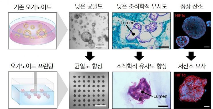 기존 암 오가노이드와 구슬 형태로 3D 바이오프린팅된 암 오가노이드 모델의 차이.