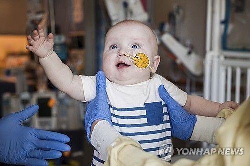 유전자 치료를 받은 생후 10개월 아기 KJ. AP 연합뉴스