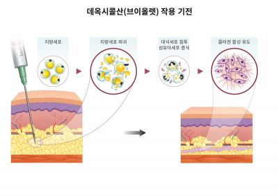 대웅제약 브이올렛 'DCA', 팔뚝 피하지방 7.5㎜↓…美 SCIE 저널 발표