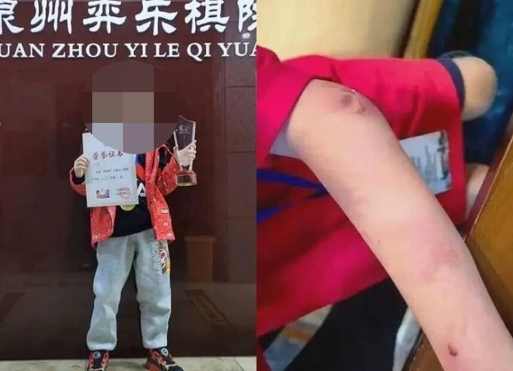 '바둑 신동'으로 알려진 중국의 9세 소년이 사망한 가운데, 생전에 그가 아버지의 상습적인 학대와 폭행에 시달렸다는 의혹이 불거졌다. 22일 베이징 뉴스 등은 바둑 천재 소년 주훙신이 지난 19일 저녁 사망했다고 전했다. 바이두