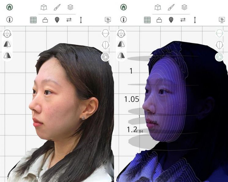 [NE 커피챗]"고가 3D 장비 없이 성형 상담 끝"…'킨사이트'의 AI 상담 혁신