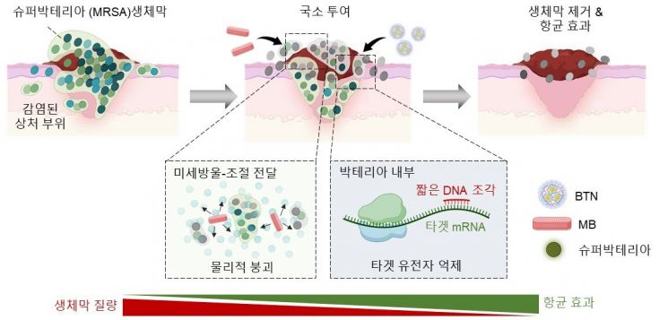 KAIST Develops "Nano-Delivery Platform" to Treat Super Bacteria Infections