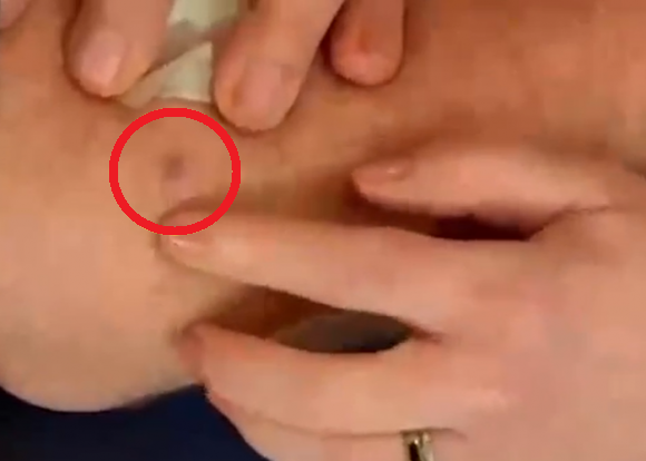 "이거 암인데요"…생방송 진행하다 의사 말 듣고 '화들짝'