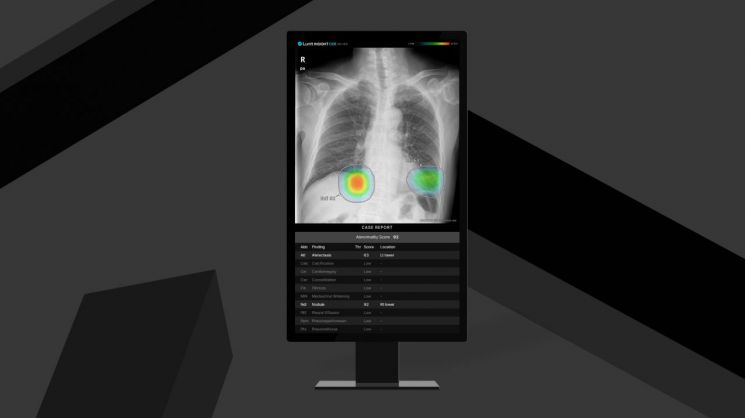 루닛  흉부 엑스레이 AI 영상분석 솔루션 '인사이트 CXR' 화면. 사진제공=루닛