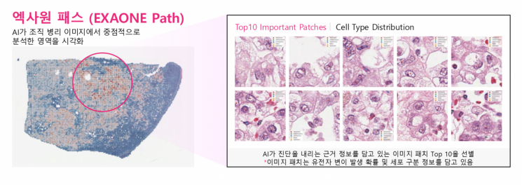 엑사원 패스는 전체 슬라이드 이미지(WSI)에서 암과 관련된 유전자 변이를 예측할 수 있다. LG.