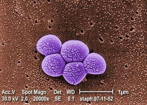 다제내성균 MRSA(메티실린 내성 황색포도상구균)를 2만 배 확대한 전자현미경 이미지. 미국 질병통제예방센터 캡처