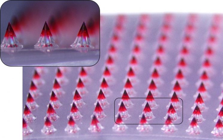 대웅테라퓨틱스가 개발한 마이크로니들 패치의 약물층을 시각적으로 표현하기 위해 색소를 첨가하고 6.7배 확대 촬영한 모습. 대웅제약