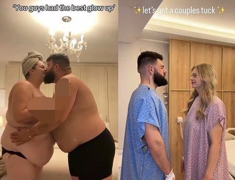 위 소매절제술을 받기 전과 받은 후의 모습. 데일리메일