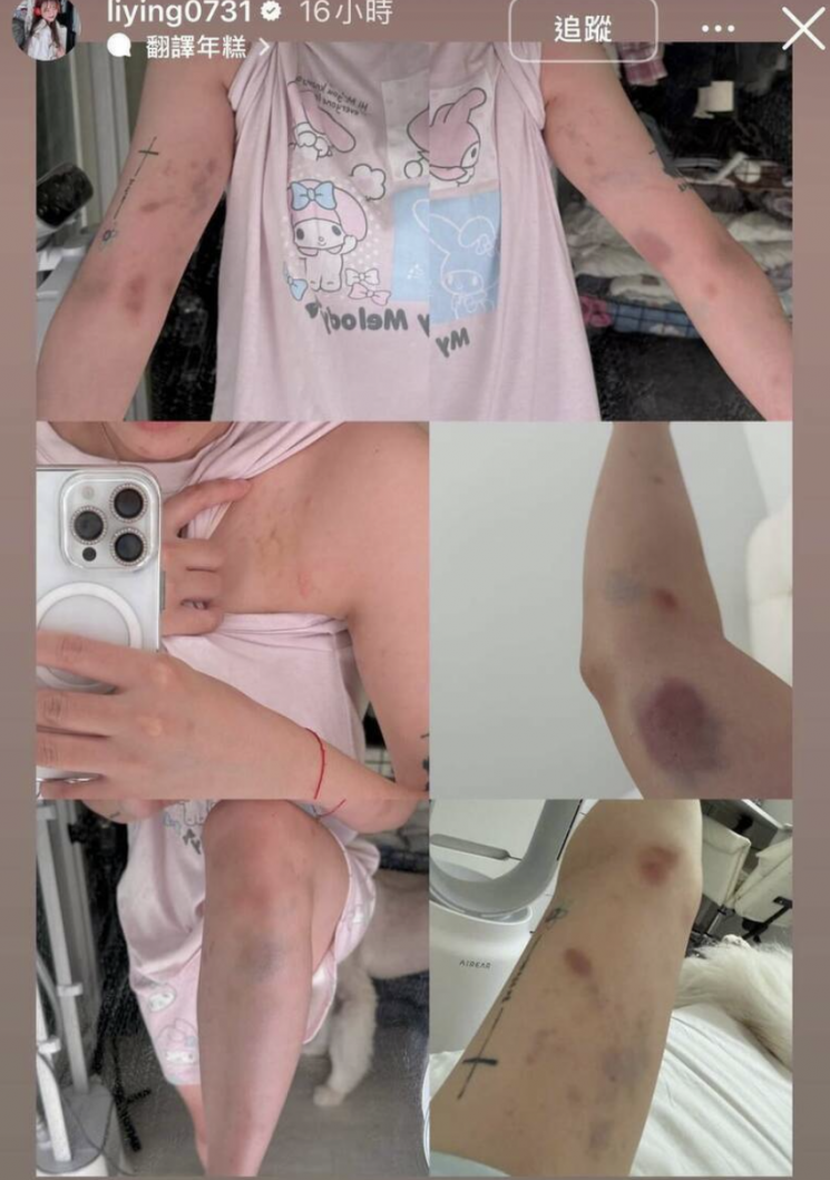 대만의 한 인기 유튜버가 서울 홍대에서 한국 남성들에게 폭행을 당했다고 주장했다. 류리잉 인스타그램