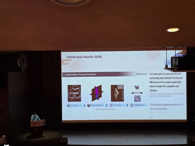 스카이브, CAOS Asia-Pacific 2025서 'AI 기반 인공관절 수술 계획' 기술 공개