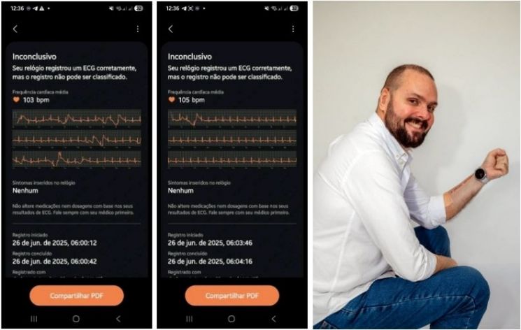 "갤럭시 워치가 날 살렸어요" 삼성전자에 감사글 보낸 브라질 남성 