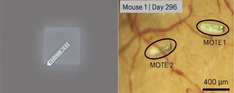소금 결정위에 있는 MOTE 뉴럴 임플란트(좌), 실험용 쥐에 이식된지 296일 지난 후의 MOTE 뉴럴 임플란트(우). KAIST 제공
