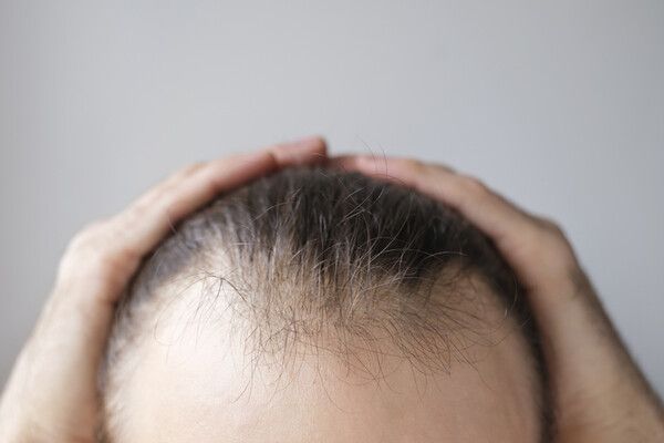 춥다고 '이것' 돌려 쓰다간 머리카락 우수수…전문가 경고