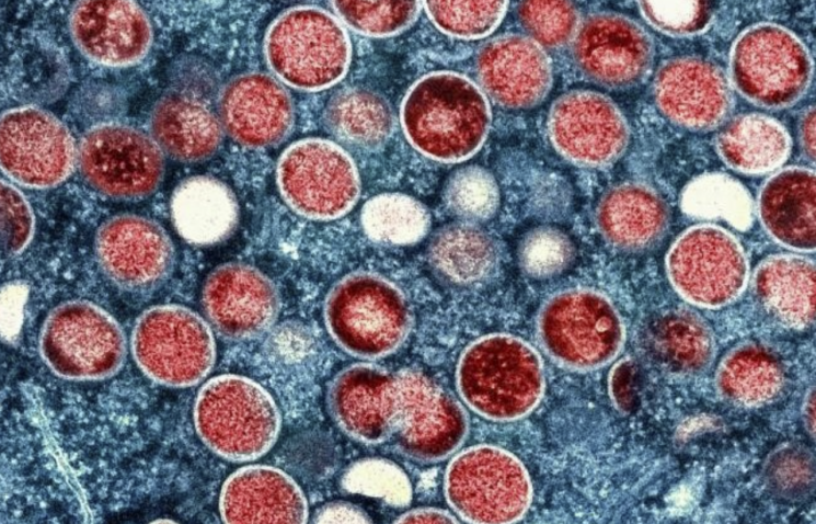 "걸리면 고열·발진" 사망자 201명인데…아시아에서 '새 변이' 발견