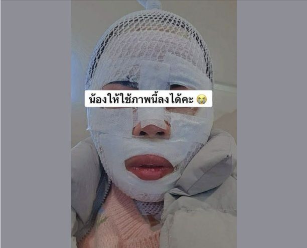 "다른 남자 만날까 봐" 태국인 아내에 끓는 물 부은 한국인 남편 붙잡혔다