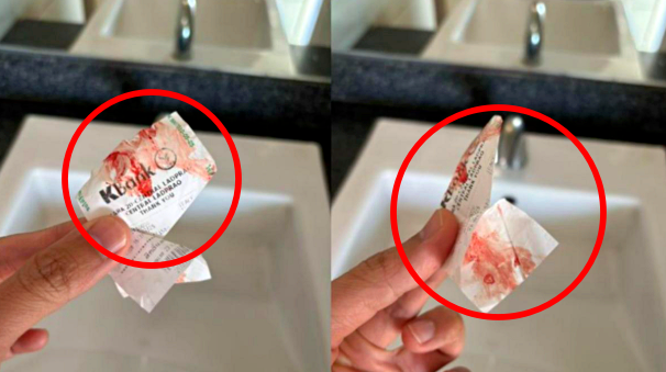 "갑자기 팔이 축축하고 끈적"…지하철에서 피 묻히고 사라진 정체불명 남성