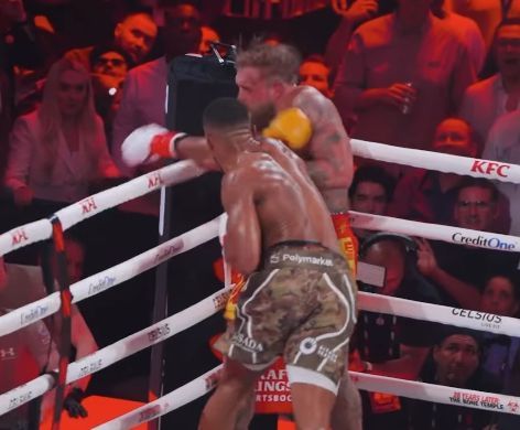 챔프 출신 한방에 턱뼈 2곳 골절…모두가 걱정했던 유튜버 근황