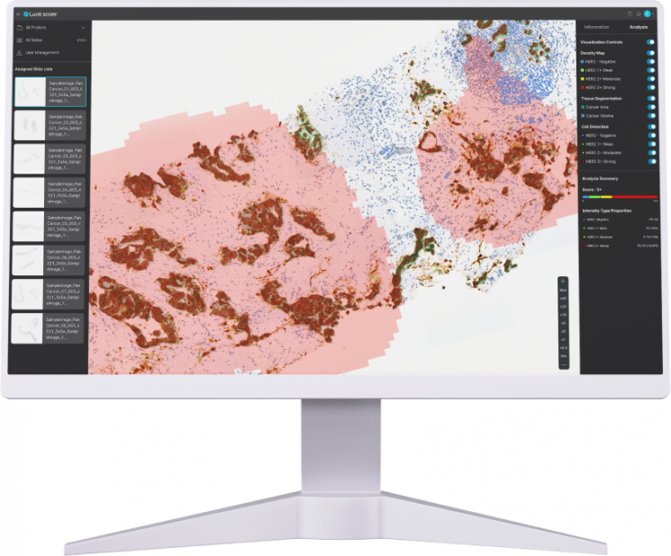 루닛, 담도암 HER2 의사-AI 판독 일치도 연구