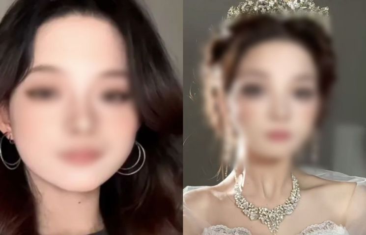 "메이크업 너무 잘하는데" 가짜 장애 의혹에 女 인플루언서 꺼내든 '이것'