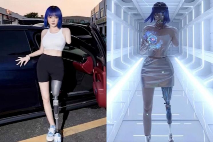 사고로 팔·다리 잃은 여성…'月 6000만원' 벌게 된 비결